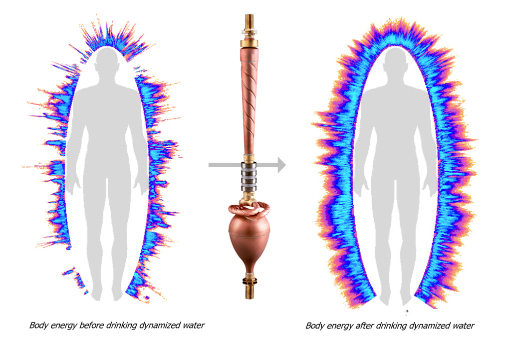 Body energy - Korotkov camera - Biodynamizer